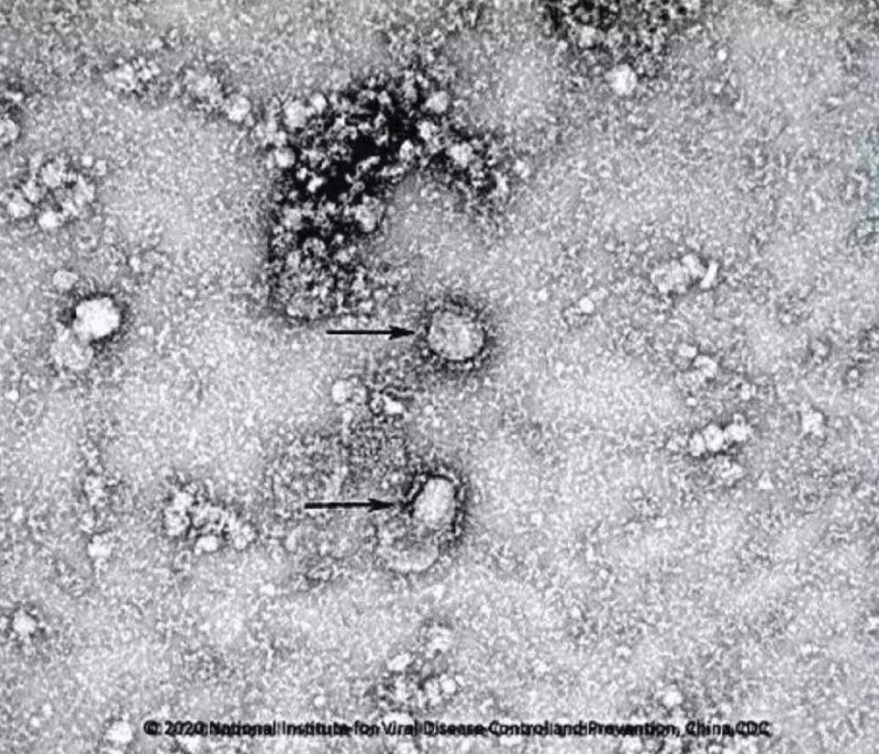 ▲新型冠狀病毒武漢株01。照片來源：國家病原微生物資源庫（中國疾病預(yù)防控制中心病毒病預(yù)防控制所）